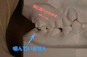 矯正歯科 名古屋市 歯並び