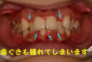 矯正歯科 名古屋市 歯並び