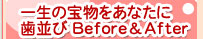 ���É� �Ђ񋸐����� �y�ꐶ�̕󕨂����Ȃ��Ɏ����сz