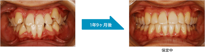 1年9ヶ月後