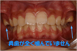 治療前の問題点