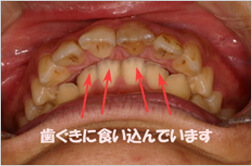 治療前の問題点