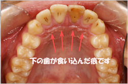 治療前の問題点