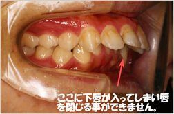 治療前の問題点